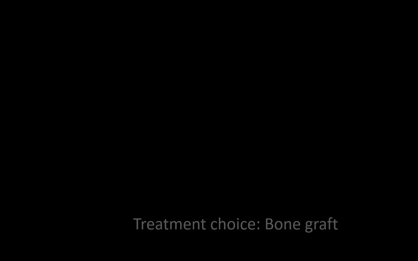 03_bone-graft-choice_3rd_pan-asia-ots_cyyang